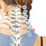 Vôi hóa cột sống: Nguyên nhân, triệu chứng, chẩn đoán và điều trị