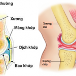Dịch tràn khớp gối: Nguyên nhân và cách chữa trị